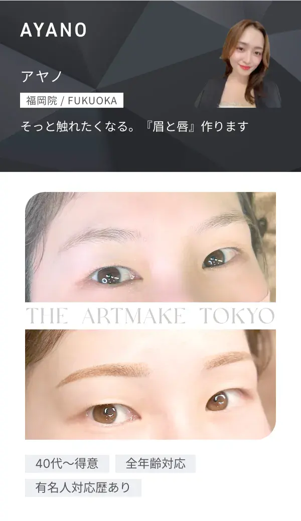 AYANO（福岡院）施術症例画像・対応特徴：40代～得意、全年齢対応、有名人対応歴あり