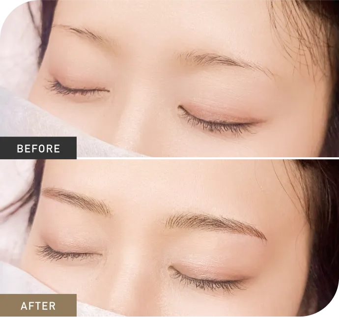 症例3 Before After