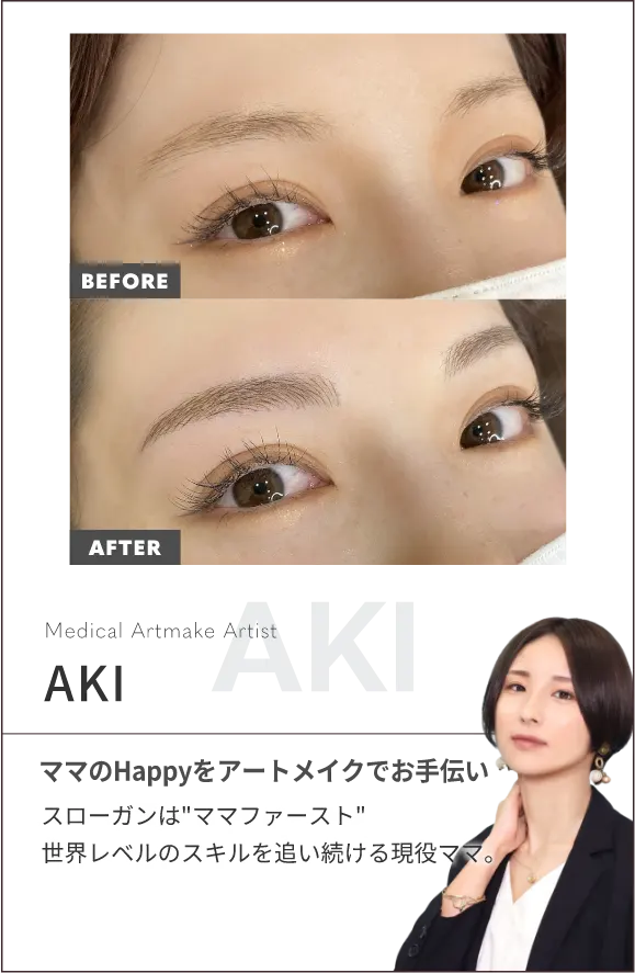 AKI