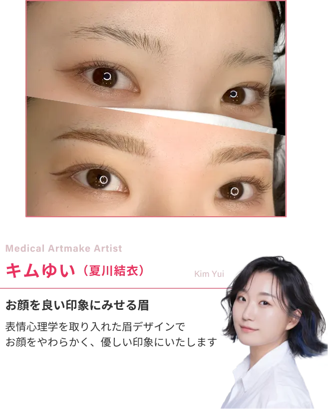 Medical Artmake Artist夏川結衣表情心理学×眉アートメイク表情心理学を取り入れた眉デザインで、お顔を柔らかく優しい印象に仕上げます。