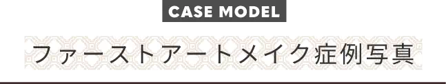 CASE MODELファーストアートメイク症例写真