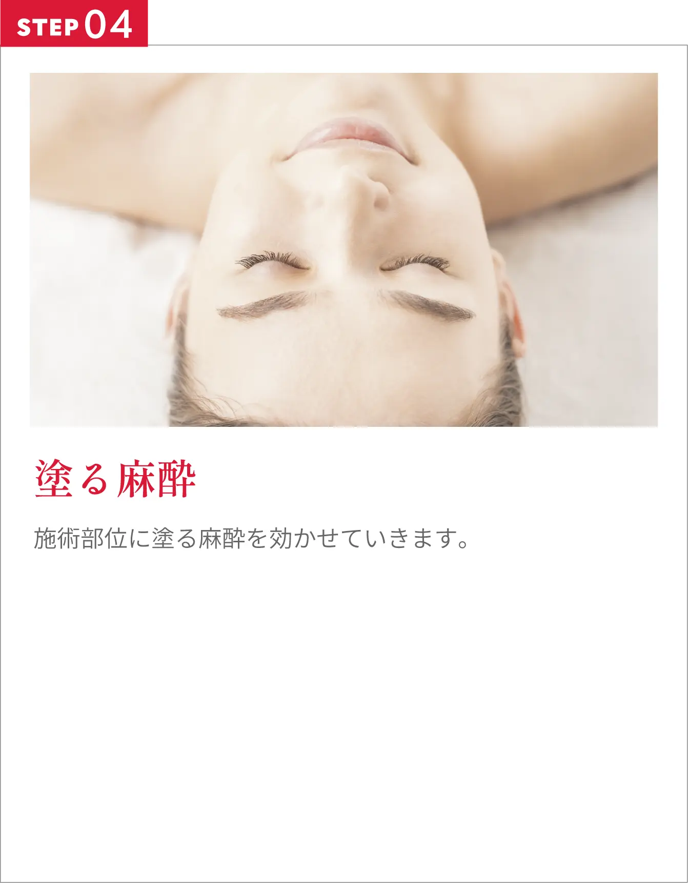 塗る麻酔施術部位に塗る麻酔を効かせていきます。