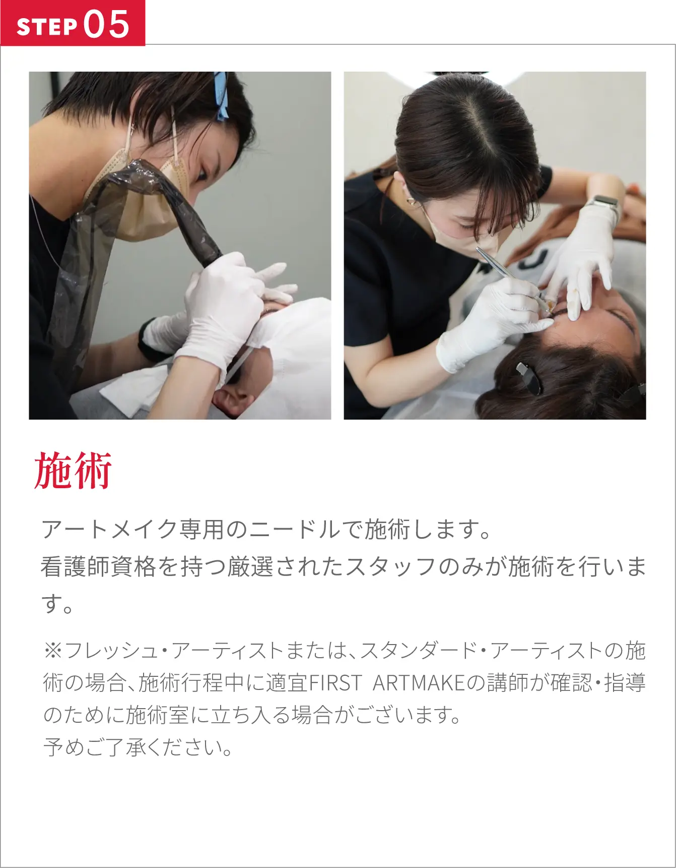 施術アートメイク専用のニードルで施術します。看護師資格を持つ厳選されたスタッフのみが施術を行います。※フレッシュ・アーティストまたは、スタンダード・アーティストの施術の場合、施術行程中に適宜FIRST ARTMAKEの講師が確認・指導のために施術室に立ち入る場合がございます。予めご了承ください。