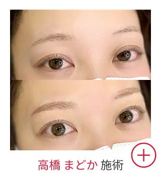 高橋 まどかの症例写真
