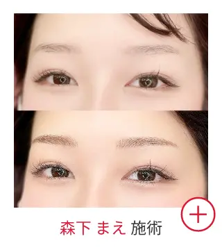 森下 まえの症例写真
