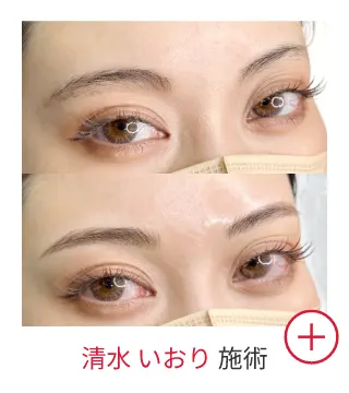清水 いおりの症例写真