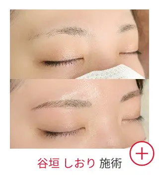 谷垣 しおりの症例写真