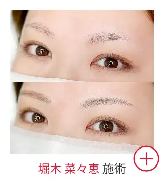堀木 菜々恵の症例写真