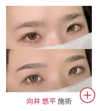 向井 悠平の症例写真