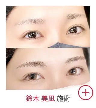 鈴木 美凪の症例写真