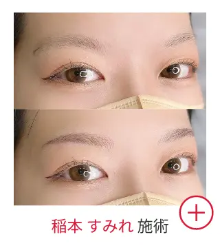 稲本 すみれの症例写真