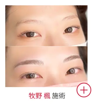 牧野 楓の症例写真