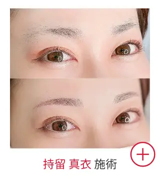 持留 真衣の症例写真
