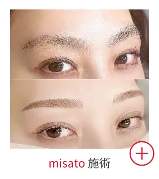misatoの症例写真
