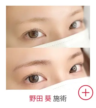 野田 葵の症例写真