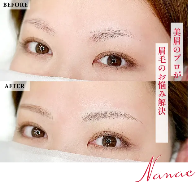 堀木 菜々恵の症例写真