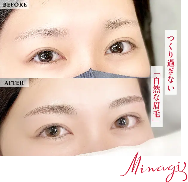 鈴木 美凪の症例写真