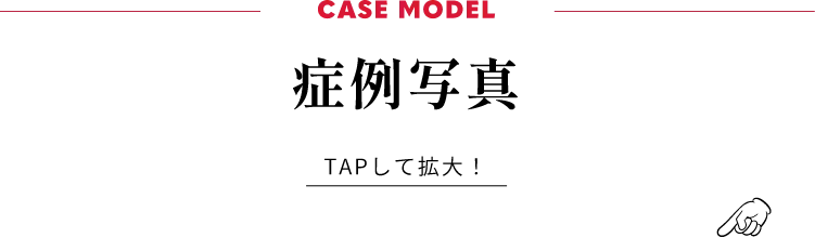 CASE MODEL症例写真