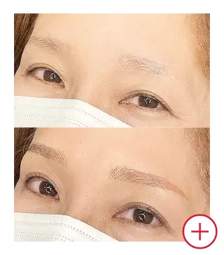 症例写真