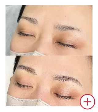 症例写真