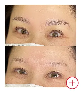 症例写真