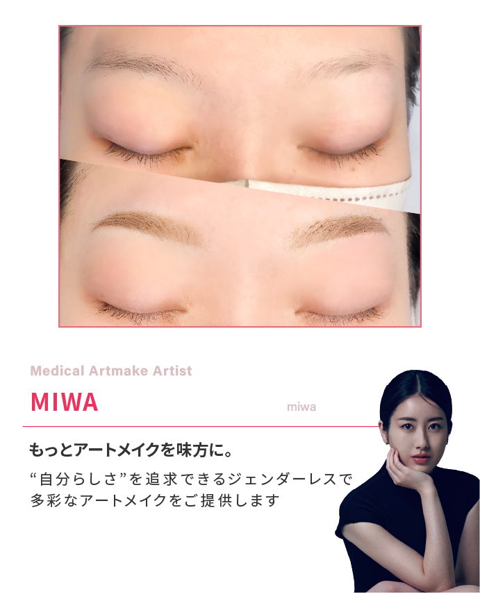 アートメイクマシーン MARA 蓄え