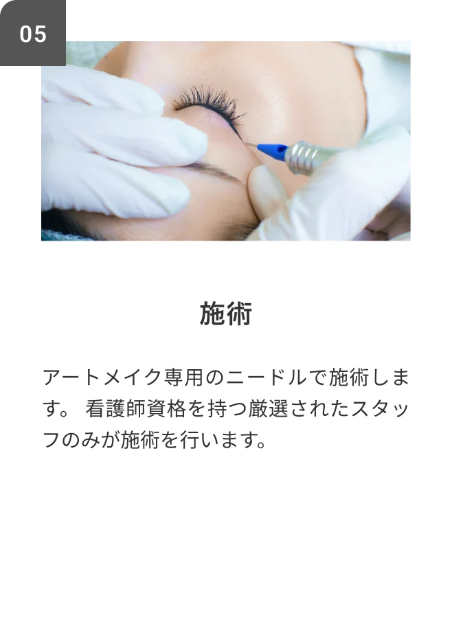 STEP05 施術 アートメイク専用のニードルで施術します。看護師資格を持つ厳選されたスタッフのみが施術を行います。