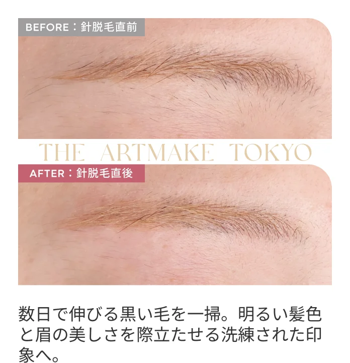 数日で伸びる黒い毛を一掃。明るい髪色と眉の美しさを際立たせる洗練された印象へ。