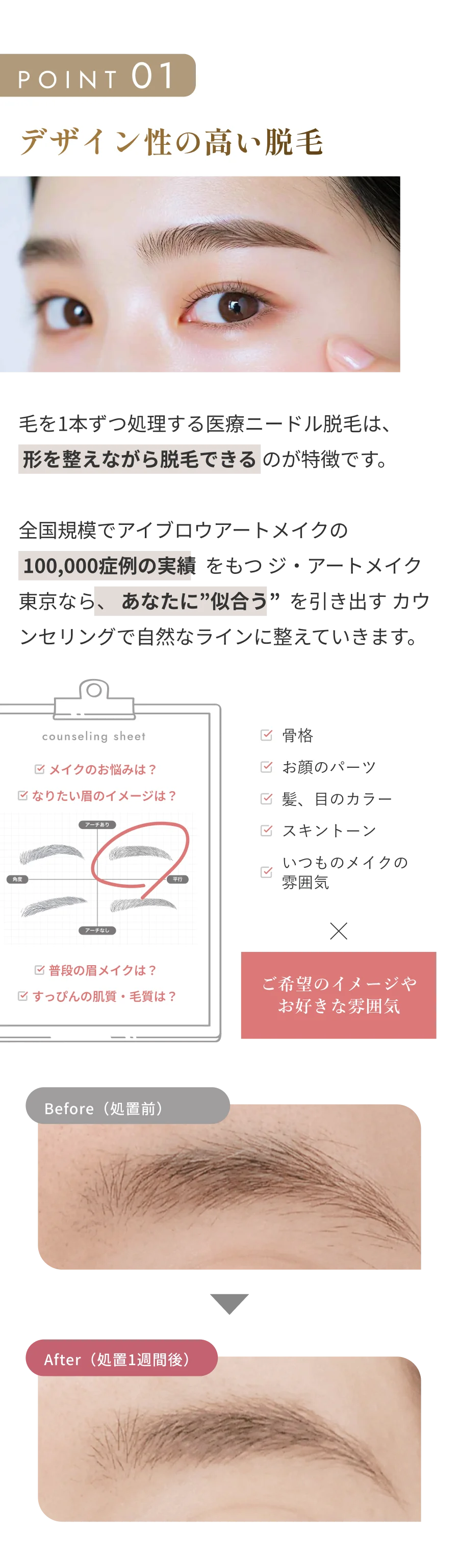 POINT 01 デザイン性の高い脱毛 毛を1本ずつ処理する医療ニードル脱毛は、形を整えながら脱毛できるのが特徴です。全国規模でアイブロウアートメイクの70,000症例の実績をもつジ・アートメイク東京なら、あなたに似合うを引き出すカウンセリングで自然なラインに整えていきます。