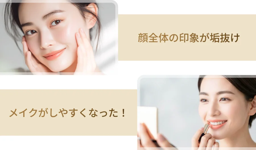 顔全体の印象が垢抜け メイクがしやすくなった！
