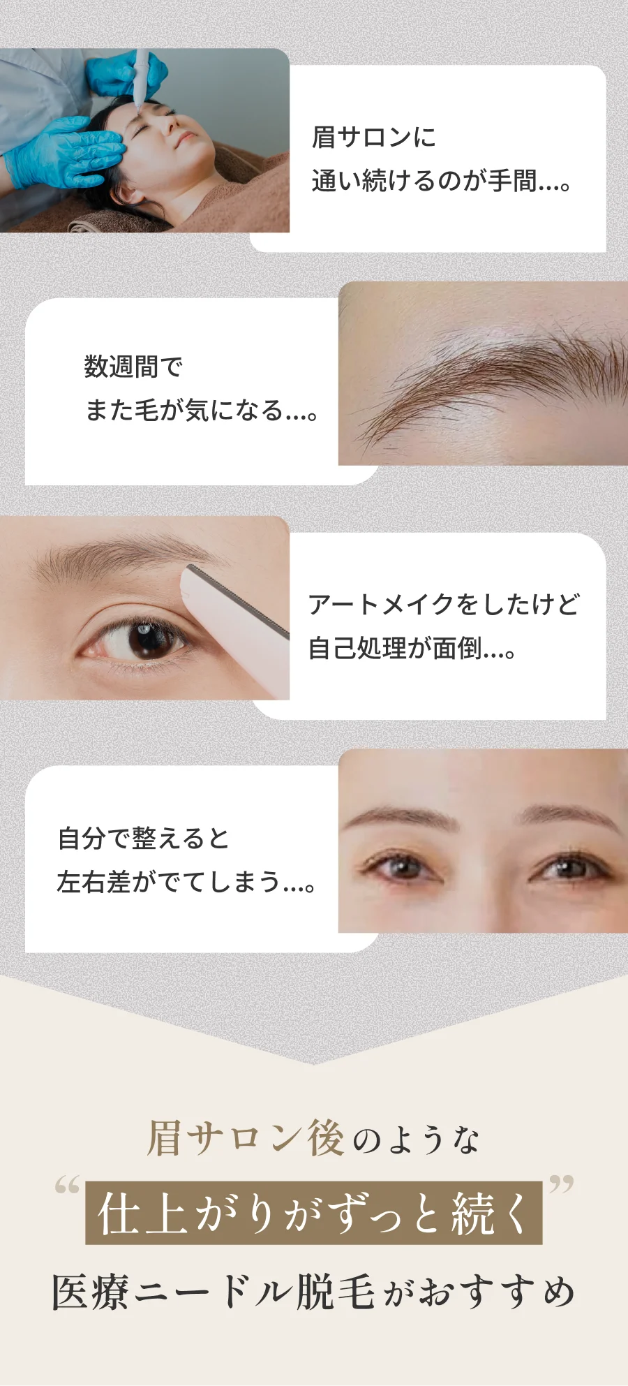 眉サロンに通い続けるのが手間...。 数週間でまた毛が気になる...。 アートメイクをしたけど自己処理が面倒...。 自分で整えると左右差がでてしまう...。 眉サロン後のような仕上がりがずっと続く 医療ニードル脱毛がおすすめ