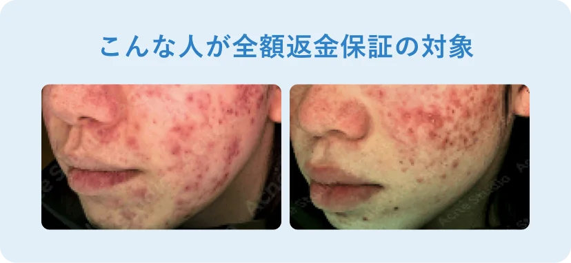 こんな人が全額返金保証の対象