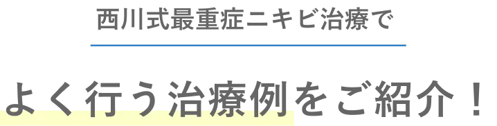 西川式最重症ニキビ治療でよく行う治療例をご紹介！