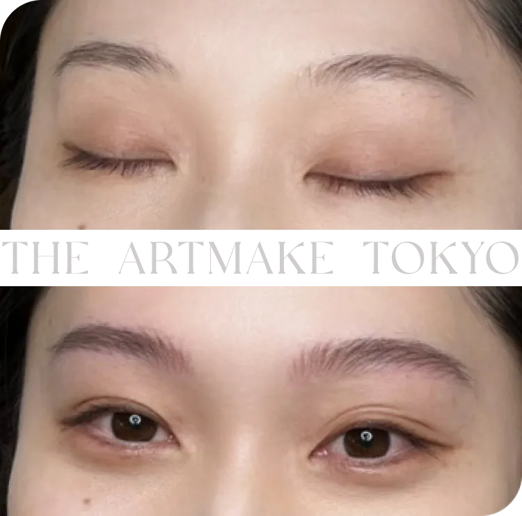松林 りほが担当したアートメイクの症例写真