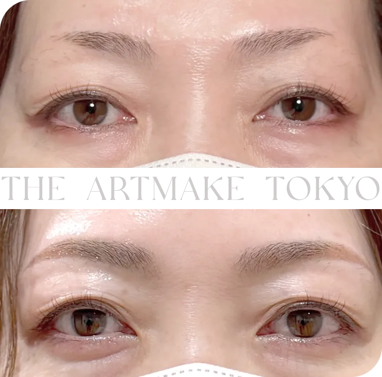 楠田 かおりが担当したアートメイクの症例写真