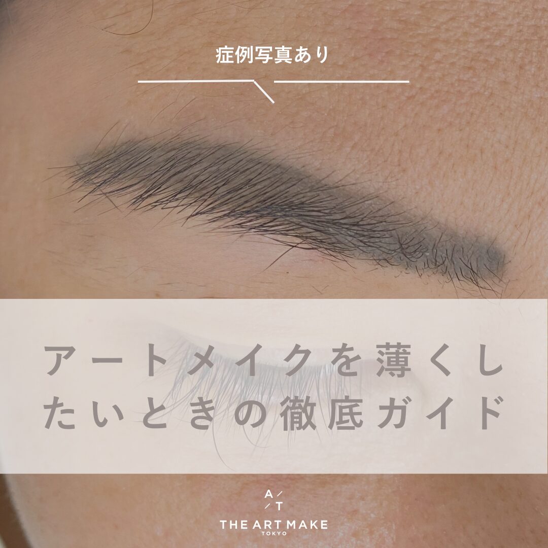 アートメイク除去 薄くしたい