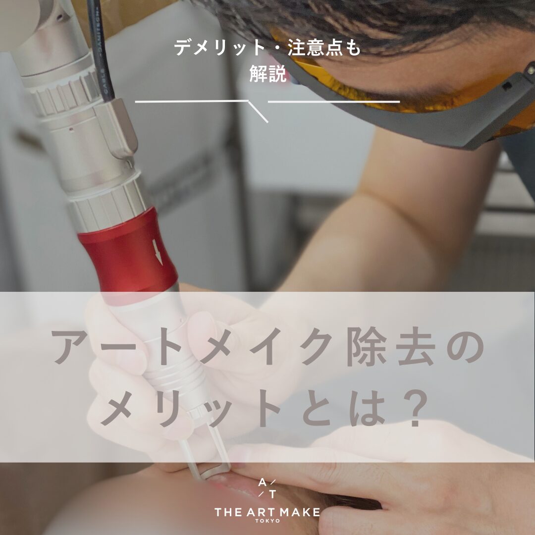 アートメイク除去