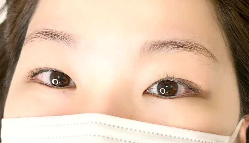 Before