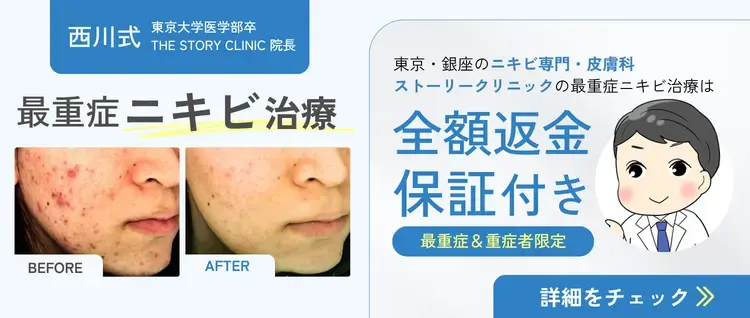 西川式 最重症ニキビ治療 全額返金保証付き